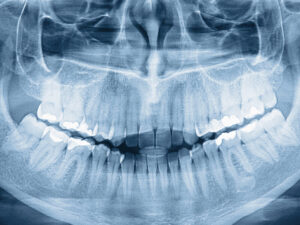 radiologia odontológica